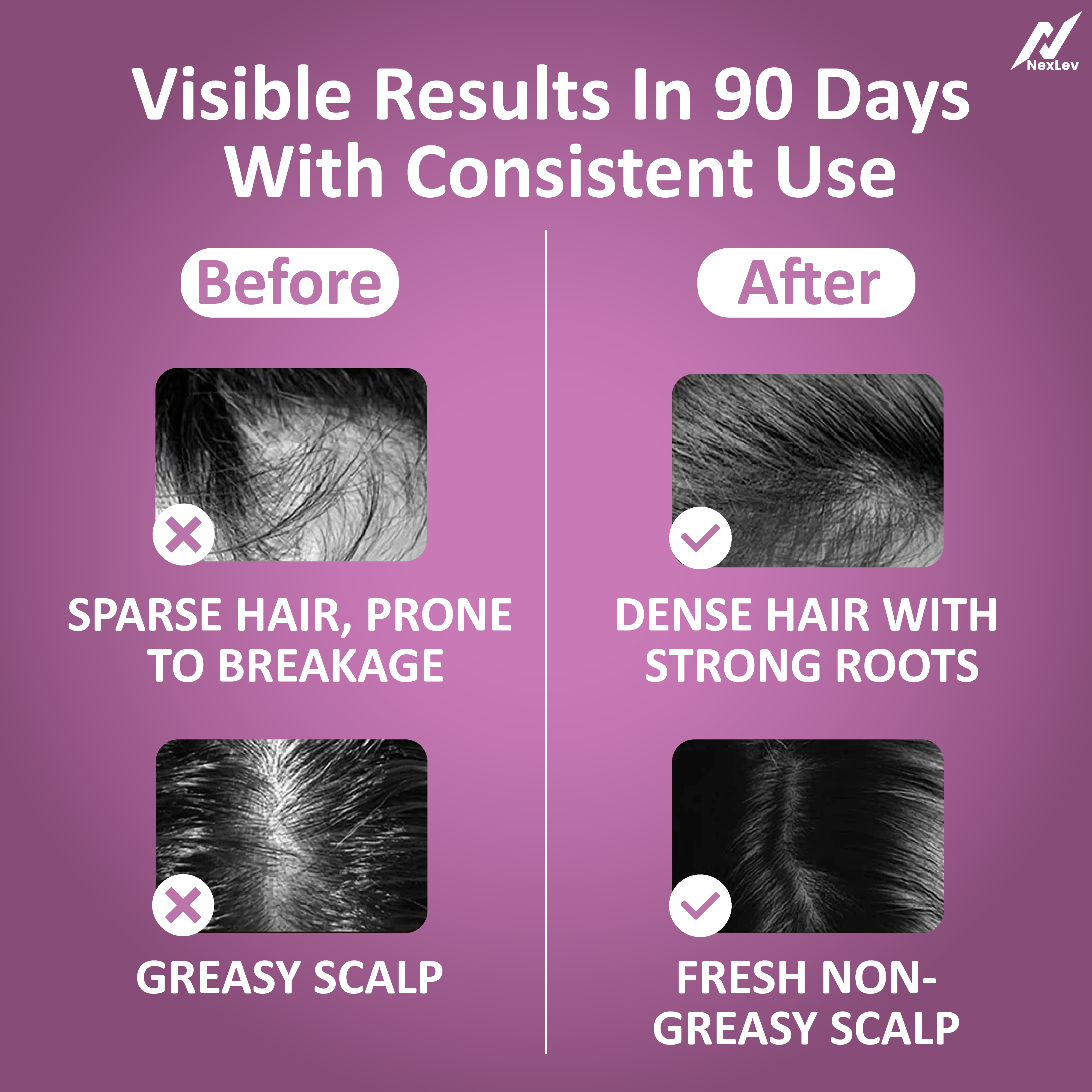 NexLev Oil Applicator Comb | EA-02