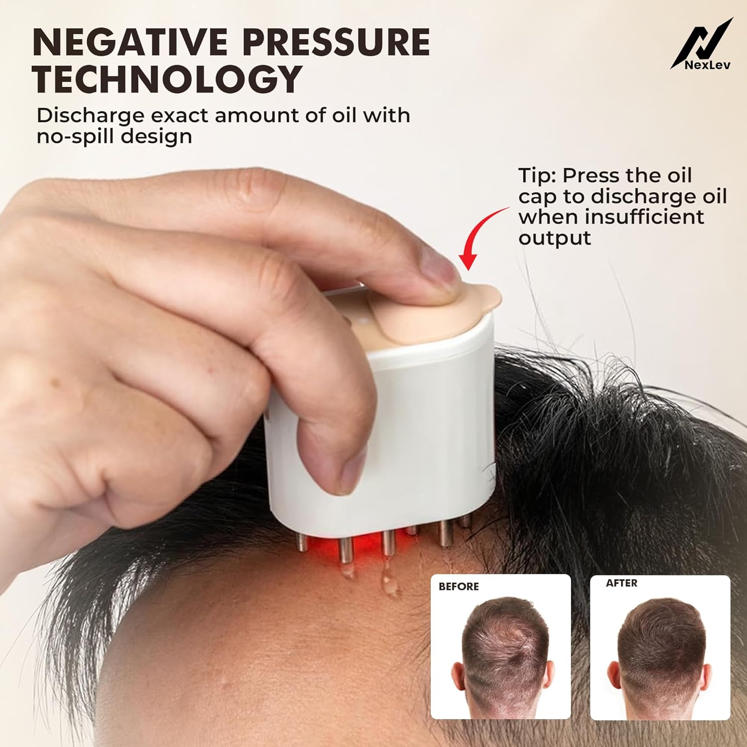 NexLev Nourish Hair Oil Applicator| Red & Blue Light Therapy EA-01 Pro