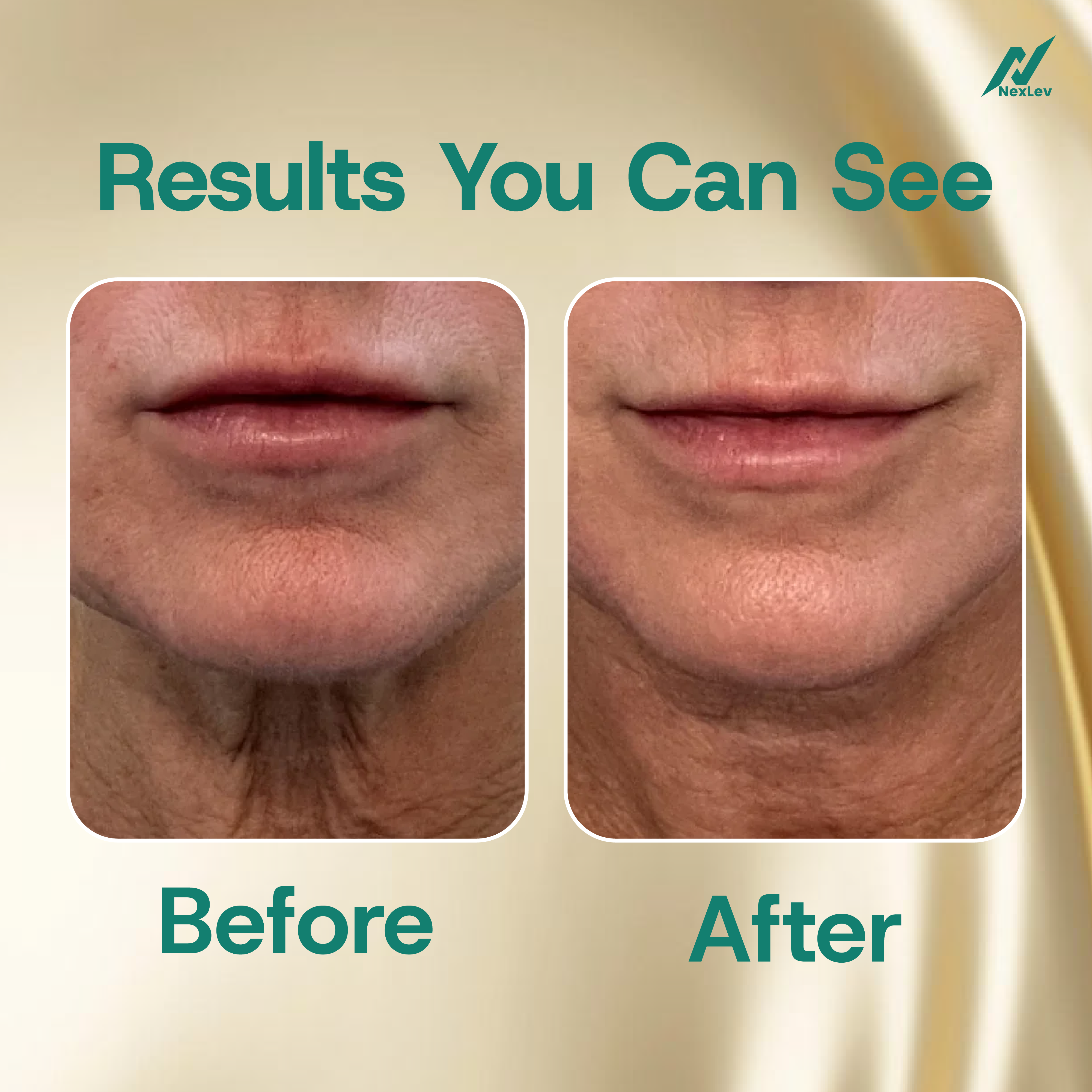 Nexlev Red Light Therapy Wand for Face and Neck | LE-06