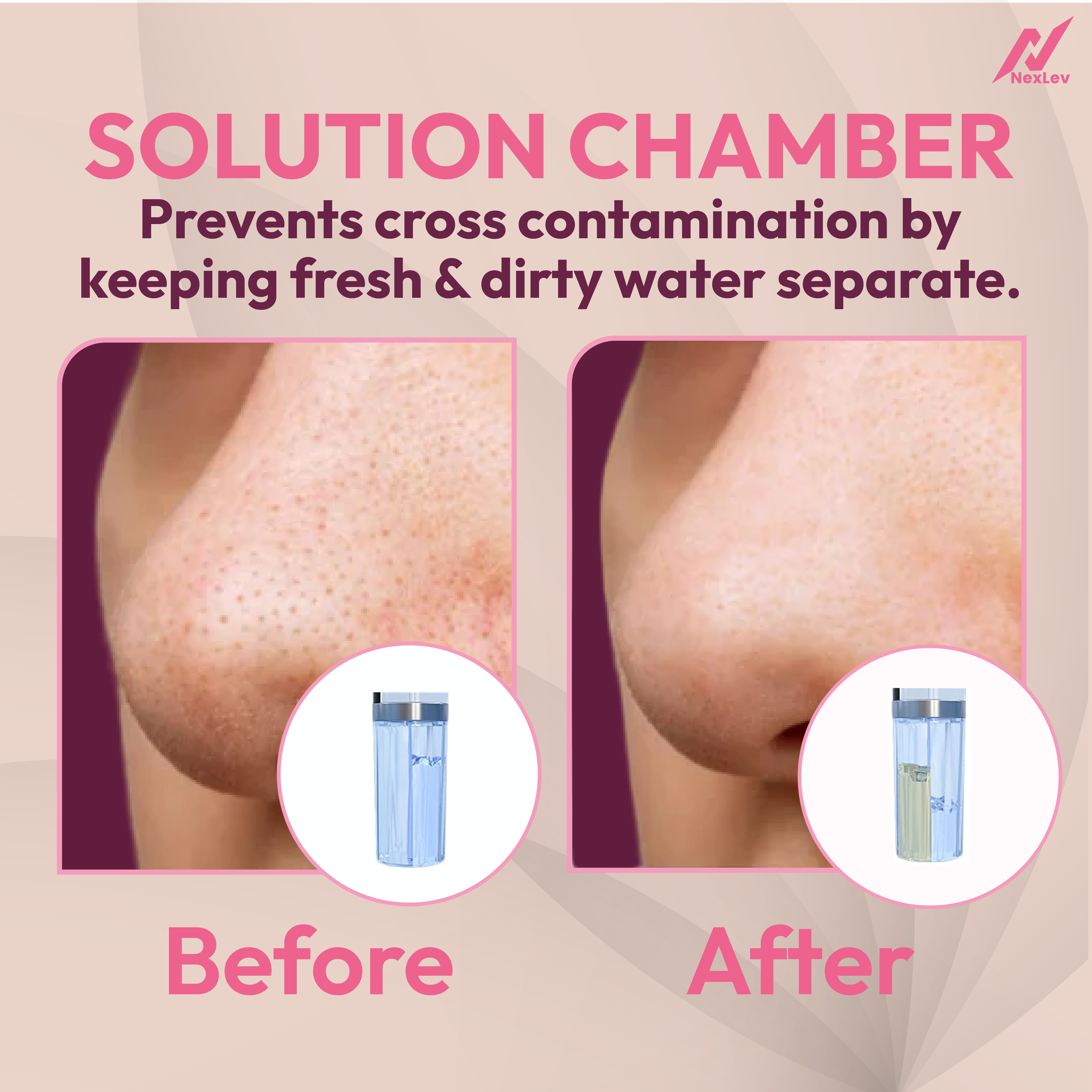 NexLev Multi-Function Blackhead Remover | BR-01